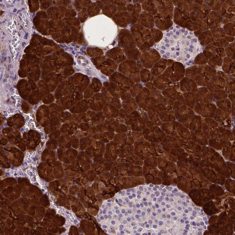 PHGDH Antibody (CL0555) - Azide and BSA Free Immunohistochemistry-Paraffin: PHGDH Antibody [NBP3-43966]
