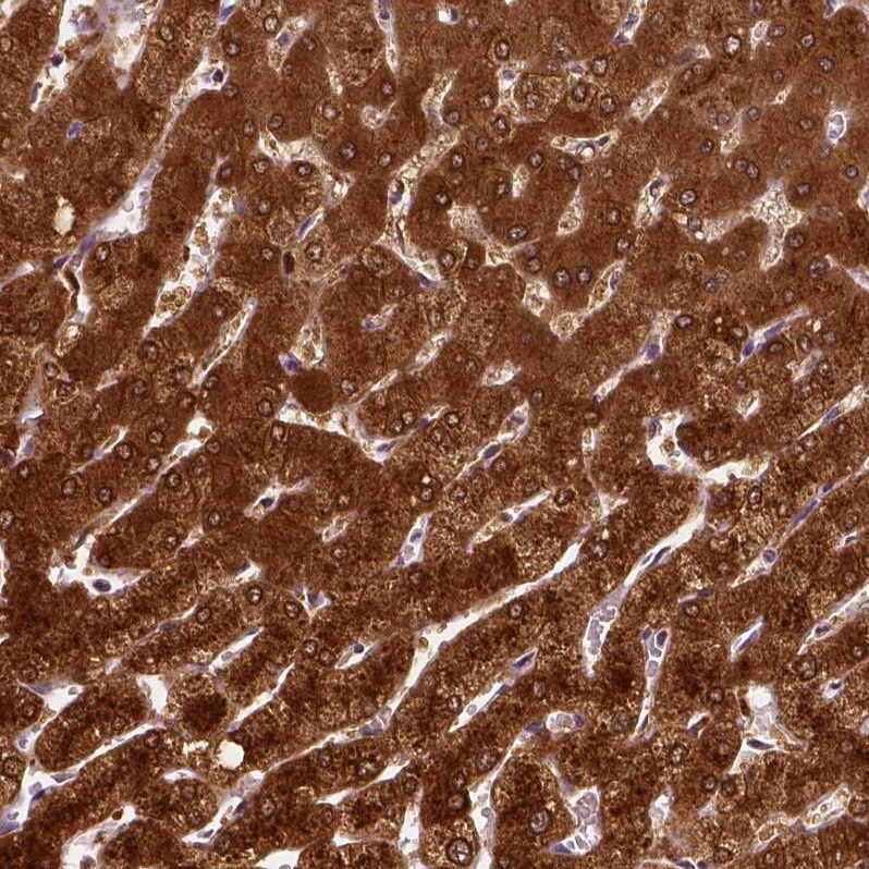 PHGDH Antibody (CL0555) - Azide and BSA Free Immunohistochemistry-Paraffin: PHGDH Antibody [NBP3-43966]