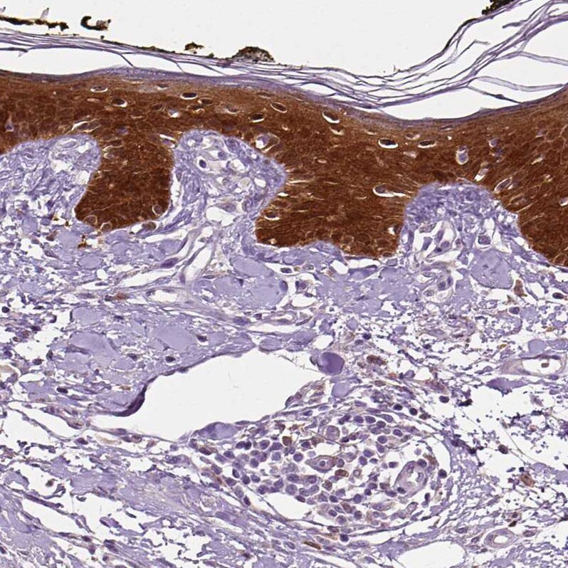 PHGDH Antibody (CL0555) - Azide and BSA Free Immunohistochemistry-Paraffin: PHGDH Antibody [NBP3-43966]