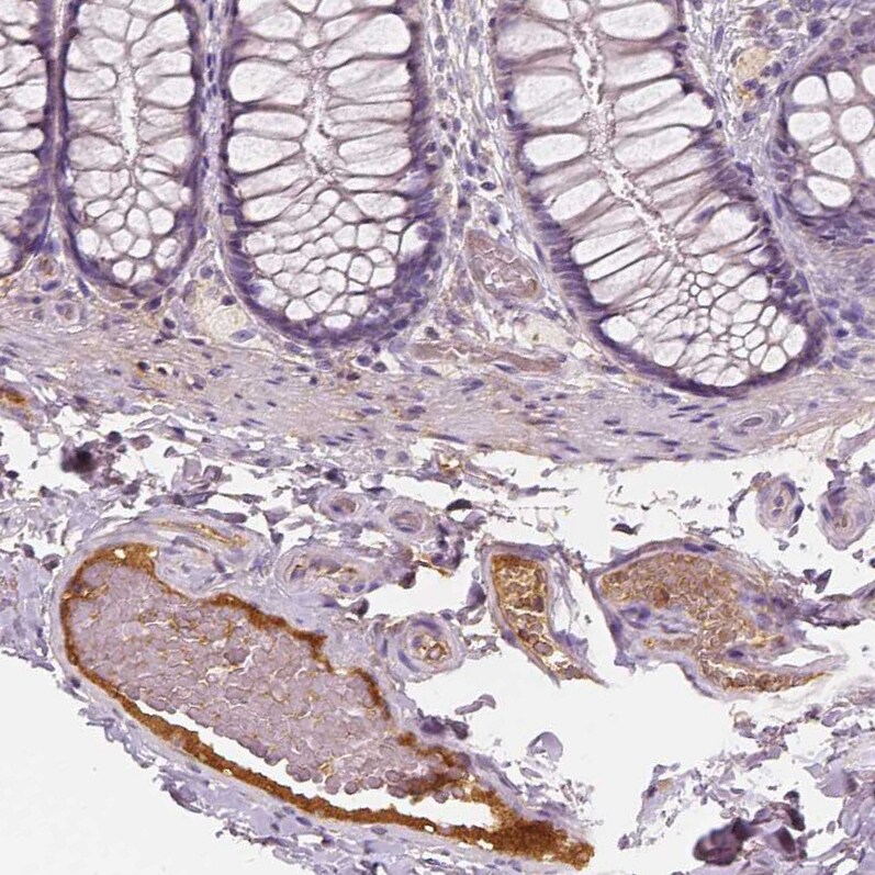 Apolipoprotein A-IV/ApoA4 Antibody (CL0465) - Azide and BSA Free Immunohistochemistry-Paraffin: Apolipoprotein A-IV/ApoA4 Antibody [NBP3-43967]