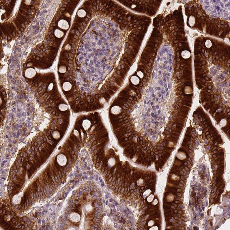 Apolipoprotein A-IV/ApoA4 Antibody (CL0465) - Azide and BSA Free Immunohistochemistry-Paraffin: Apolipoprotein A-IV/ApoA4 Antibody [NBP3-43967]