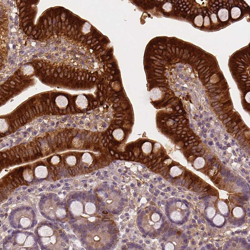 Apolipoprotein A-IV/ApoA4 Antibody (CL0467) - Azide and BSA Free Immunohistochemistry-Paraffin: Apolipoprotein A-IV/ApoA4 Antibody [NBP3-43968]