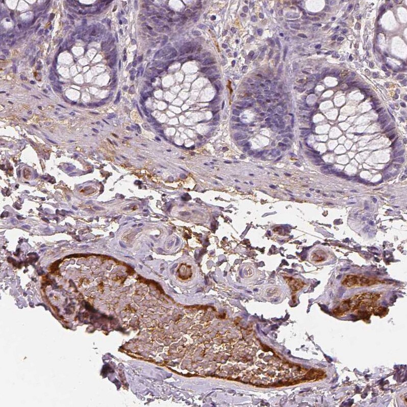 Apolipoprotein A-IV/ApoA4 Antibody (CL0467) - Azide and BSA Free Immunohistochemistry-Paraffin: Apolipoprotein A-IV/ApoA4 Antibody [NBP3-43968]