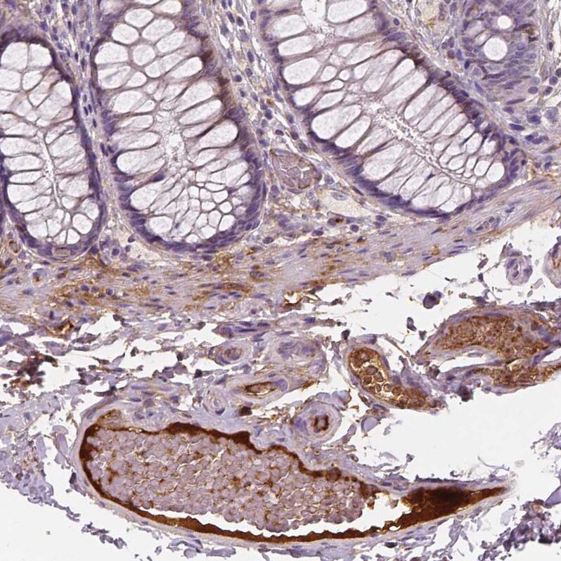 Apolipoprotein A-IV/ApoA4 Antibody (CL0468) - Azide and BSA Free Immunohistochemistry-Paraffin: Apolipoprotein A-IV/ApoA4 Antibody [NBP3-43969]