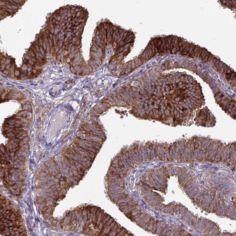 P4HA2 Antibody (CL0351) - Azide and BSA Free Immunohistochemistry-Paraffin: P4HA2 Antibody [NBP3-43972]