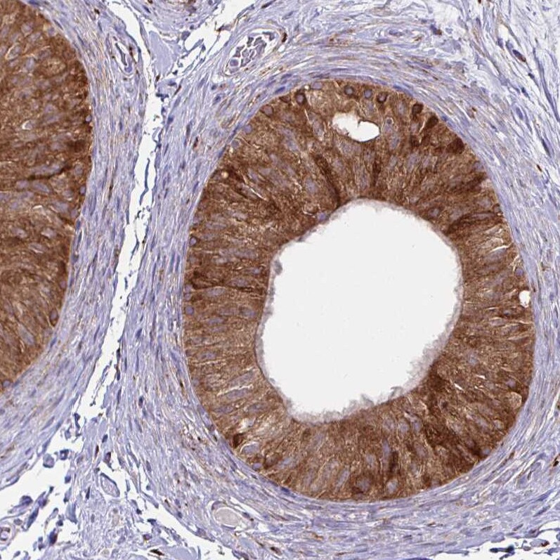 P4HA2 Antibody (CL0351) - Azide and BSA Free Immunohistochemistry-Paraffin: P4HA2 Antibody [NBP3-43972]