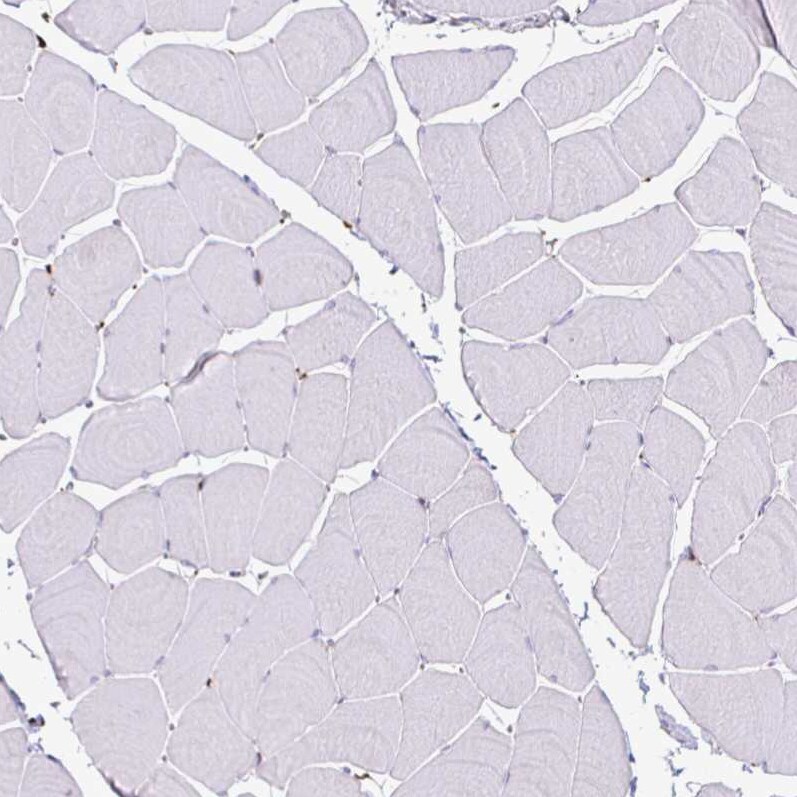 P4HA2 Antibody (CL0351) - Azide and BSA Free Immunohistochemistry-Paraffin: P4HA2 Antibody [NBP3-43972]