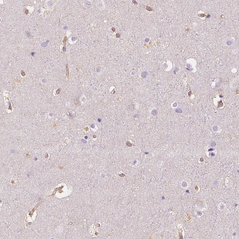 NAPRT1 Antibody (CL0366) - Azide and BSA Free Immunohistochemistry-Paraffin: NAPRT1 Antibody [NBP3-43973]
