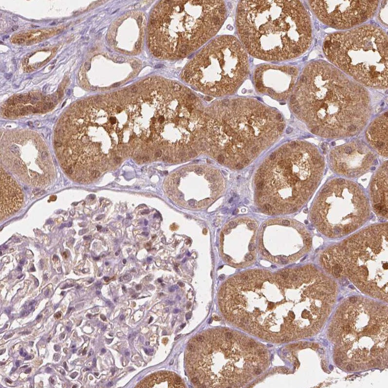 NAPRT1 Antibody (CL0366) - Azide and BSA Free Immunohistochemistry-Paraffin: NAPRT1 Antibody [NBP3-43973]