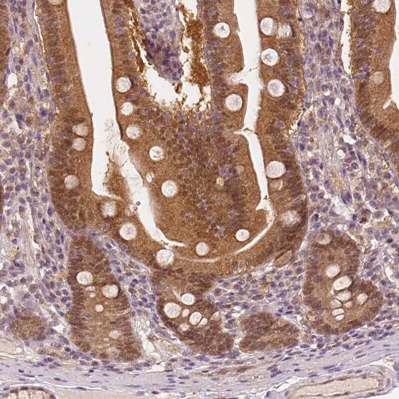 NAPRT1 Antibody (CL0366) - Azide and BSA Free Immunohistochemistry-Paraffin: NAPRT1 Antibody [NBP3-43973]
