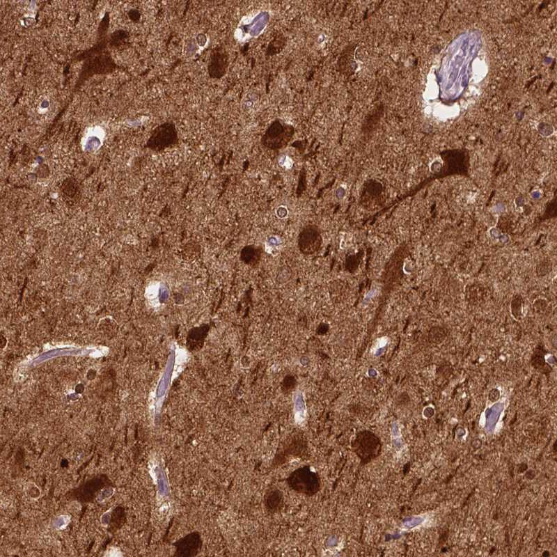 NECAB1 Antibody (CL0580) - Azide and BSA Free Immunohistochemistry-Paraffin: NECAB1 Antibody [NBP3-43974]