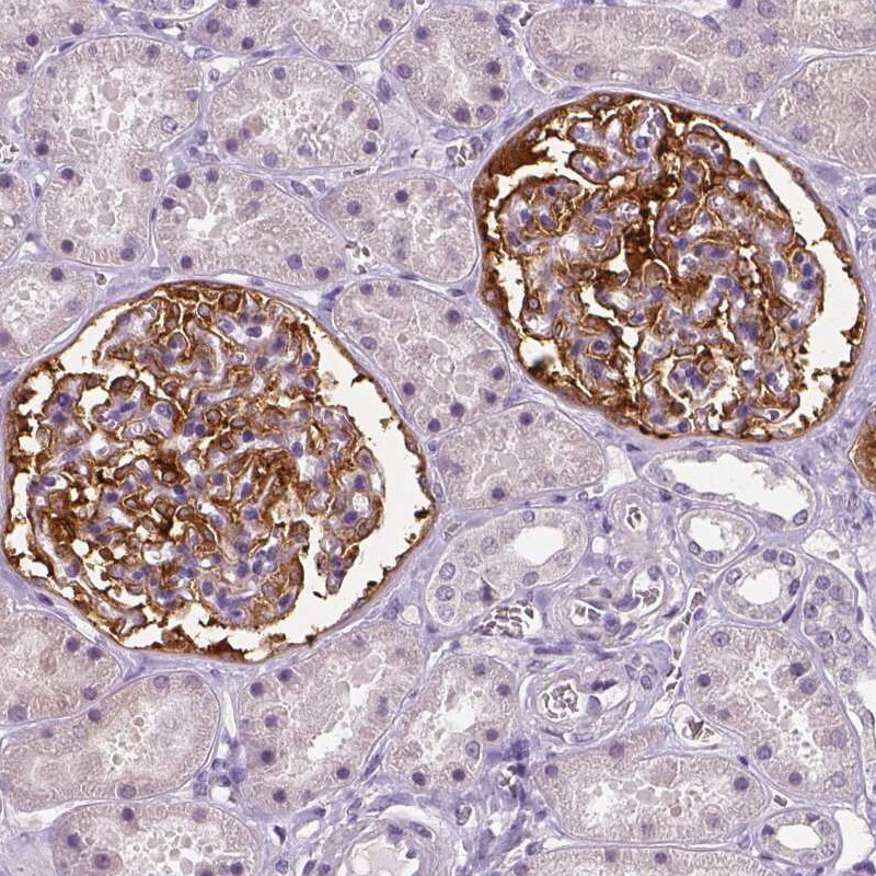 NECAB1 Antibody (CL0575) - Azide and BSA Free Immunohistochemistry-Paraffin: NECAB1 Antibody [NBP3-43975]