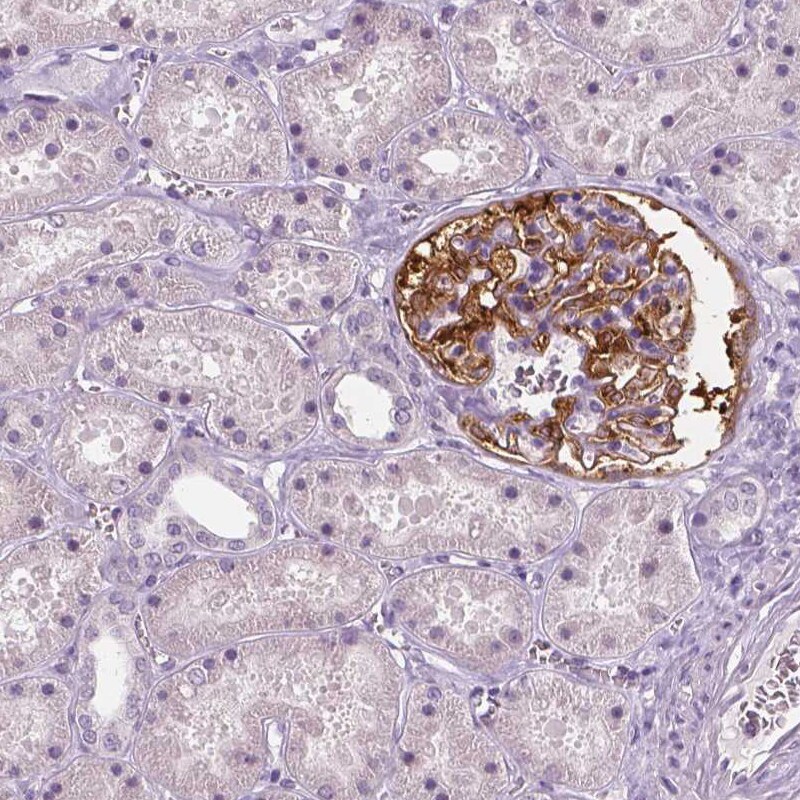 NECAB1 Antibody (CL0576) - Azide and BSA Free Immunohistochemistry-Paraffin: NECAB1 Antibody [NBP3-43976]