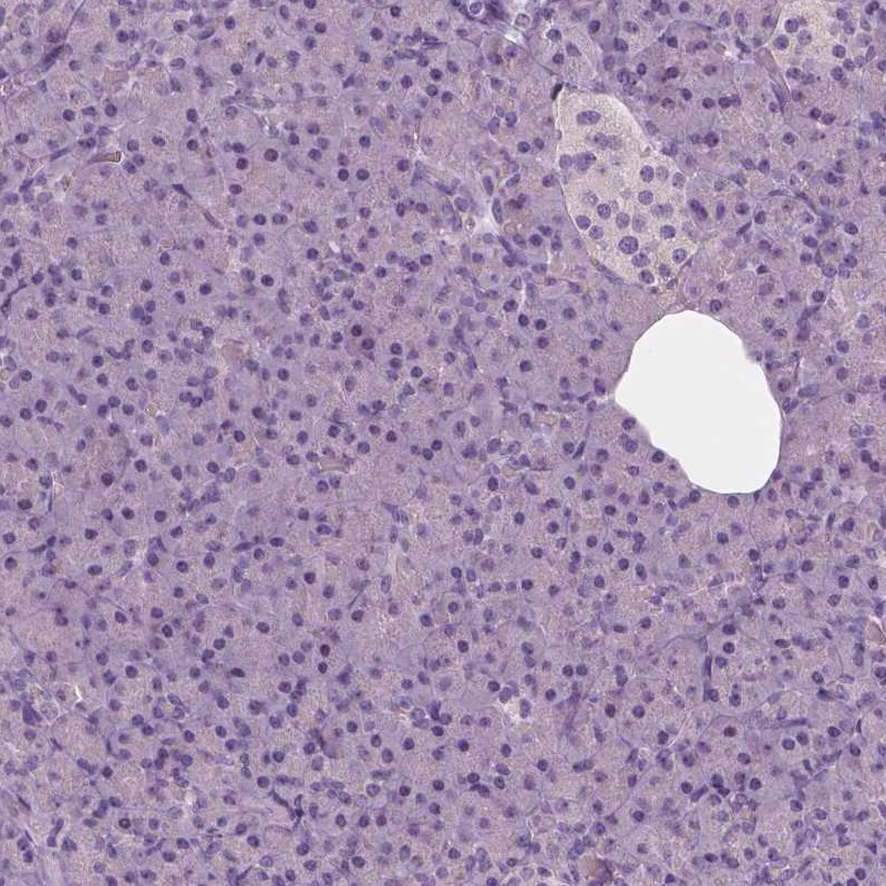 NECAB1 Antibody (CL0576) - Azide and BSA Free Immunohistochemistry-Paraffin: NECAB1 Antibody [NBP3-43976]
