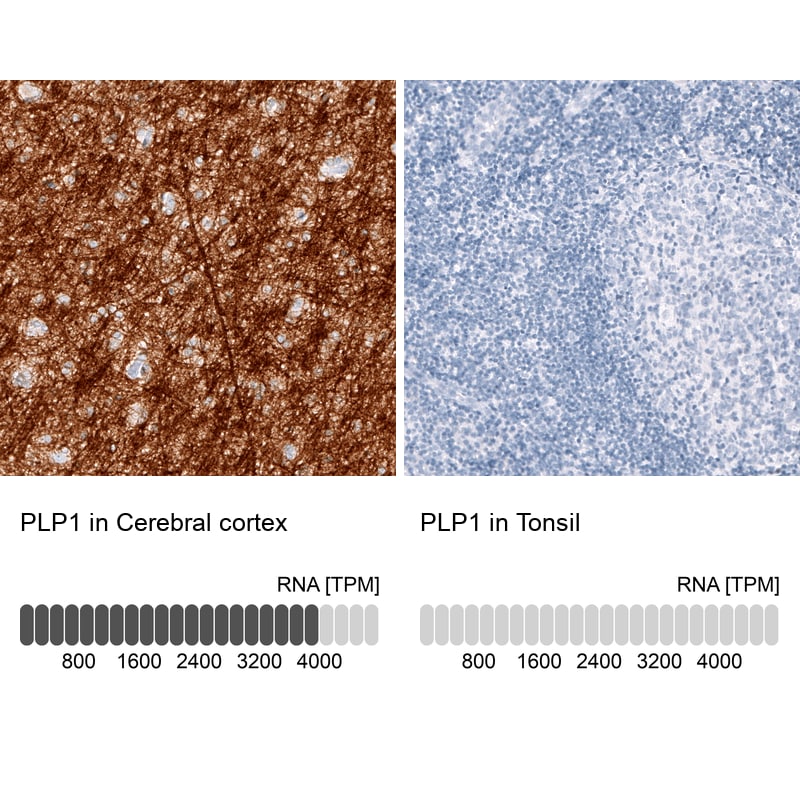 Myelin PLP Antibody (CL10622) - Azide and BSA Free Immunohistochemistry-Paraffin: Myelin PLP Antibody [NBP3-43977]