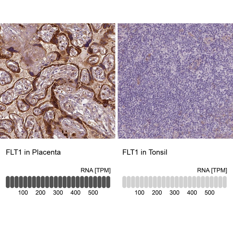 VEGFR1/Flt-1 Antibody (CL0345) - Azide and BSA Free Immunohistochemistry-Paraffin: VEGFR1/Flt-1 Antibody [NBP3-43978]