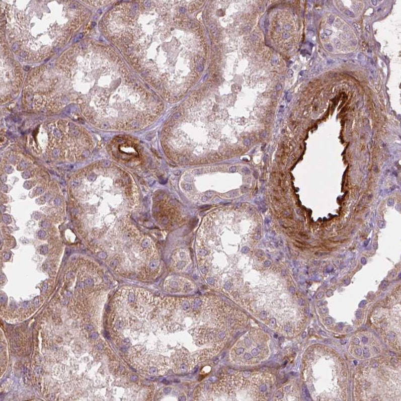 VEGFR1/Flt-1 Antibody (CL0345) - Azide and BSA Free Immunohistochemistry-Paraffin: VEGFR1/Flt-1 Antibody [NBP3-43978]