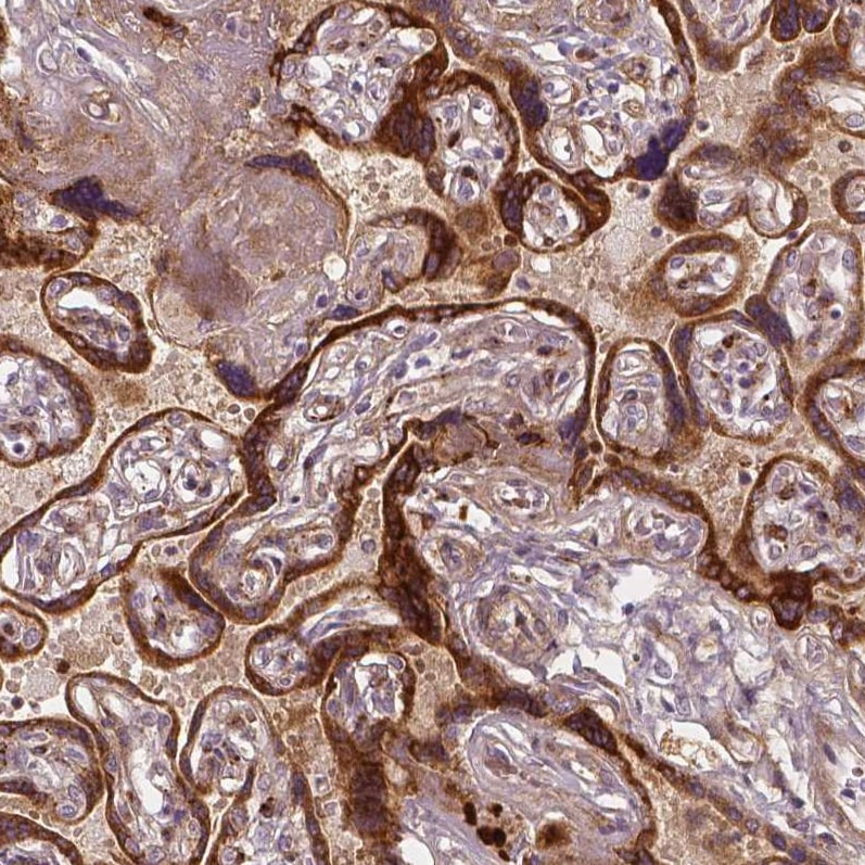 VEGFR1/Flt-1 Antibody (CL0345) - Azide and BSA Free Immunohistochemistry-Paraffin: VEGFR1/Flt-1 Antibody [NBP3-43978]