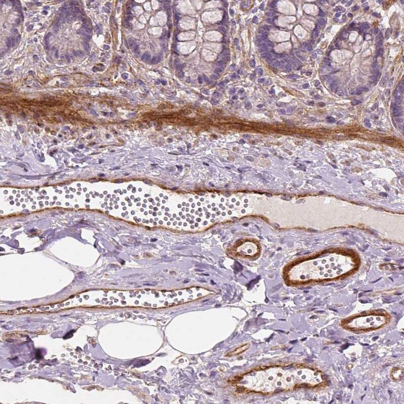 VEGFR1/Flt-1 Antibody (CL0345) - Azide and BSA Free Immunohistochemistry-Paraffin: VEGFR1/Flt-1 Antibody [NBP3-43978]