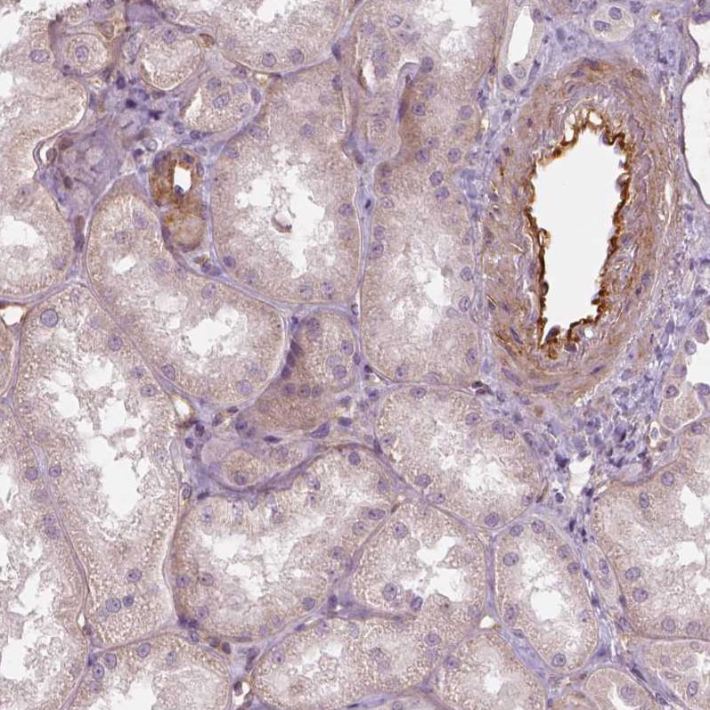 VEGFR1/Flt-1 Antibody (CL0344) - Azide and BSA Free Immunohistochemistry-Paraffin: VEGFR1/Flt-1 Antibody [NBP3-43979]