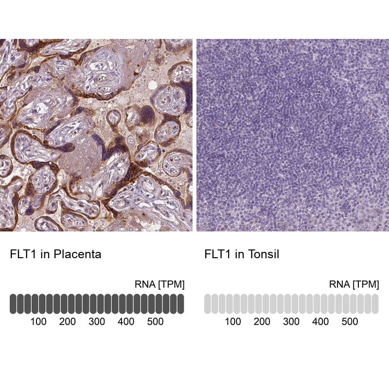 VEGFR1/Flt-1 Antibody (CL0344) - Azide and BSA Free Immunohistochemistry-Paraffin: VEGFR1/Flt-1 Antibody [NBP3-43979]