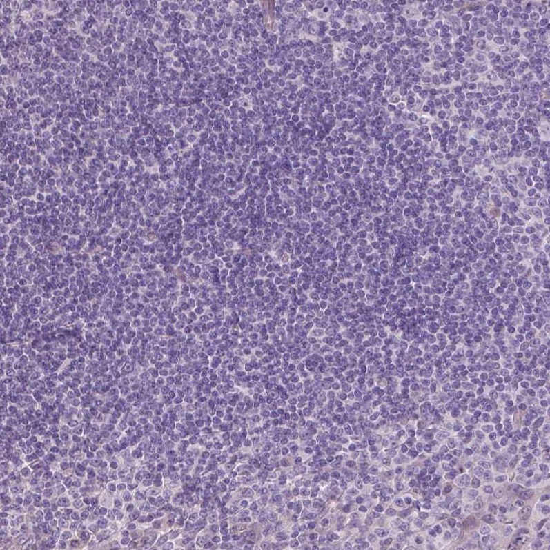 VEGFR1/Flt-1 Antibody (CL0344) - Azide and BSA Free Immunohistochemistry-Paraffin: VEGFR1/Flt-1 Antibody [NBP3-43979]