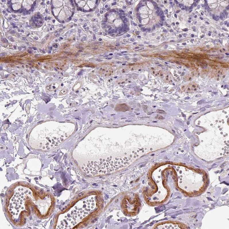 VEGFR1/Flt-1 Antibody (CL0344) - Azide and BSA Free Immunohistochemistry-Paraffin: VEGFR1/Flt-1 Antibody [NBP3-43979]