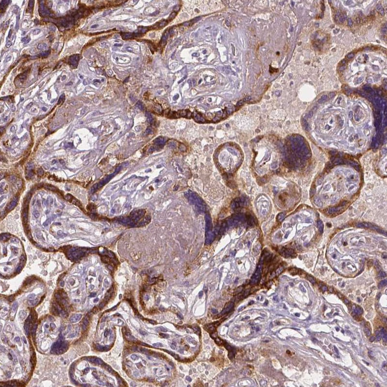 VEGFR1/Flt-1 Antibody (CL0344) - Azide and BSA Free Immunohistochemistry-Paraffin: VEGFR1/Flt-1 Antibody [NBP3-43979]