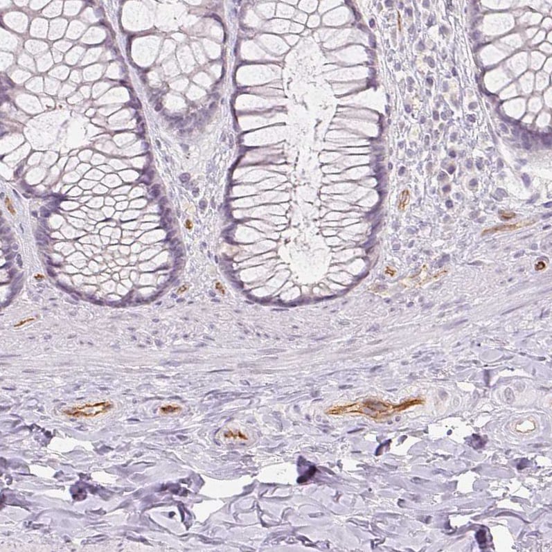 Podocalyxin Like Antibody (CL0284) - Azide and BSA Free Immunohistochemistry-Paraffin: Podocalyxin Like Antibody [NBP3-43980]