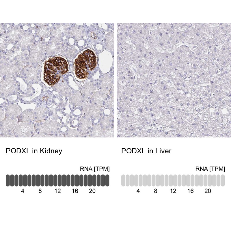 Podocalyxin Like Antibody (CL0308) - Azide and BSA Free Immunohistochemistry-Paraffin: Podocalyxin Like Antibody [NBP3-43981]