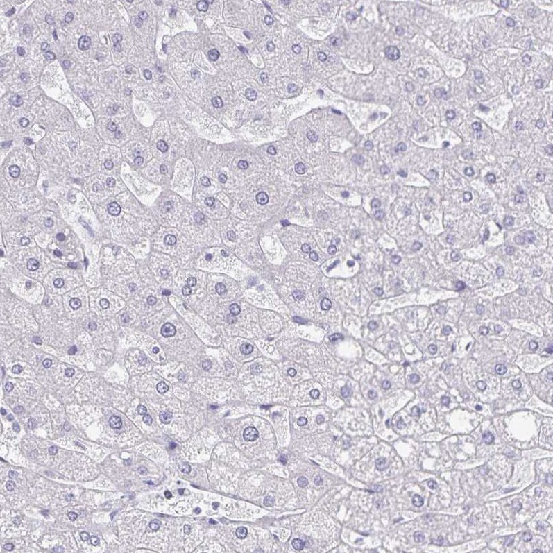 Podocalyxin Like Antibody (CL0308) - Azide and BSA Free Immunohistochemistry-Paraffin: Podocalyxin Like Antibody [NBP3-43981]