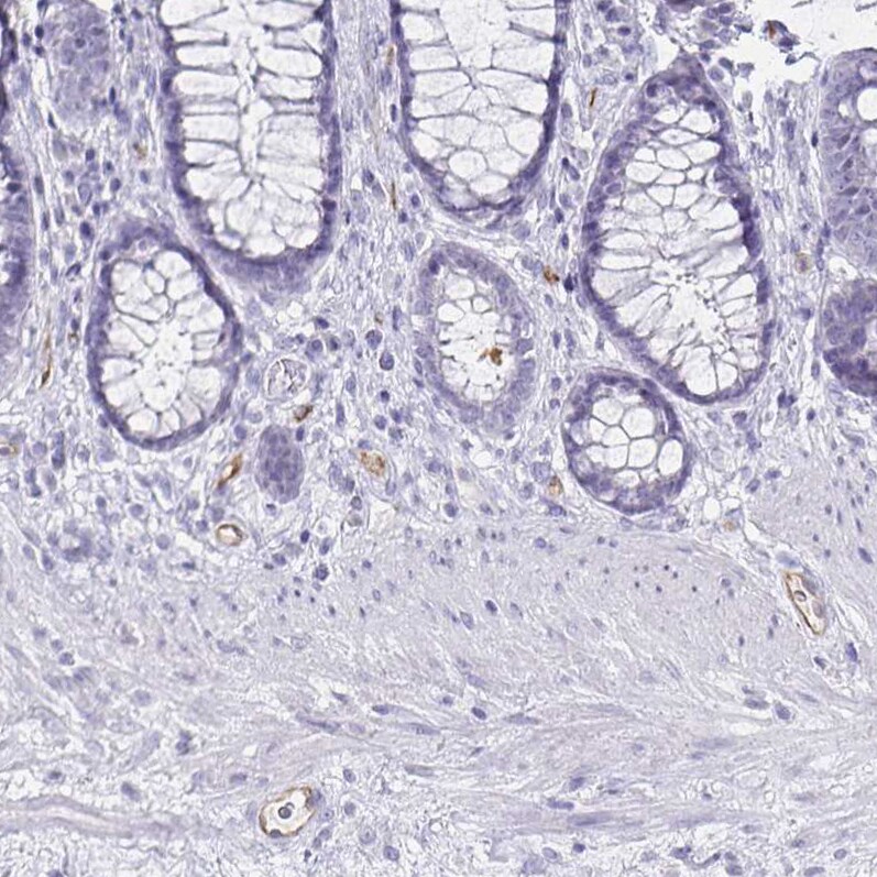 Podocalyxin Like Antibody (CL0308) - Azide and BSA Free Immunohistochemistry-Paraffin: Podocalyxin Like Antibody [NBP3-43981]