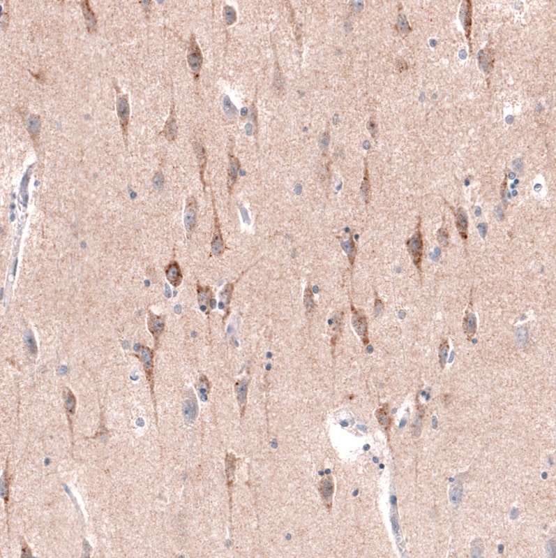 CTGF/CCN2 Antibody (CL5339) - Azide and BSA Free Immunohistochemistry-Paraffin: CTGF/CCN2 Antibody [NBP3-43982]