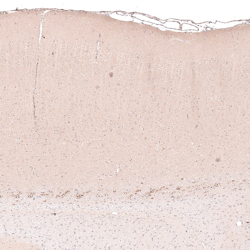 CTGF/CCN2 Antibody (CL5339) - Azide and BSA Free Immunohistochemistry-Paraffin: CTGF/CCN2 Antibody [NBP3-43982]