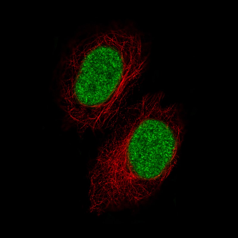 GDF-15 Antibody (CL0328) - Azide and BSA Free Immunocytochemistry/ Immunofluorescence: GDF-15 Antibody [NBP3-43983]