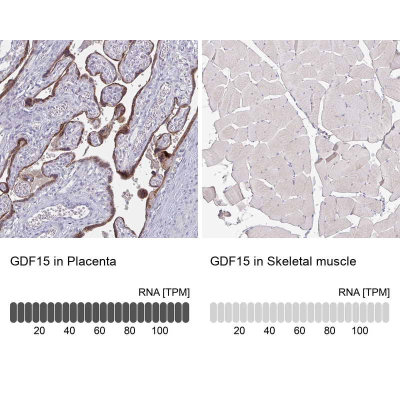 GDF-15 Antibody (CL0328) - Azide and BSA Free Immunohistochemistry-Paraffin: GDF-15 Antibody [NBP3-43983]