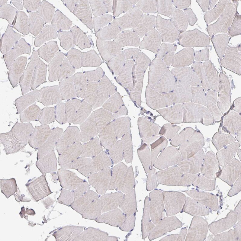 GDF-15 Antibody (CL0328) - Azide and BSA Free Immunohistochemistry-Paraffin: GDF-15 Antibody [NBP3-43983]
