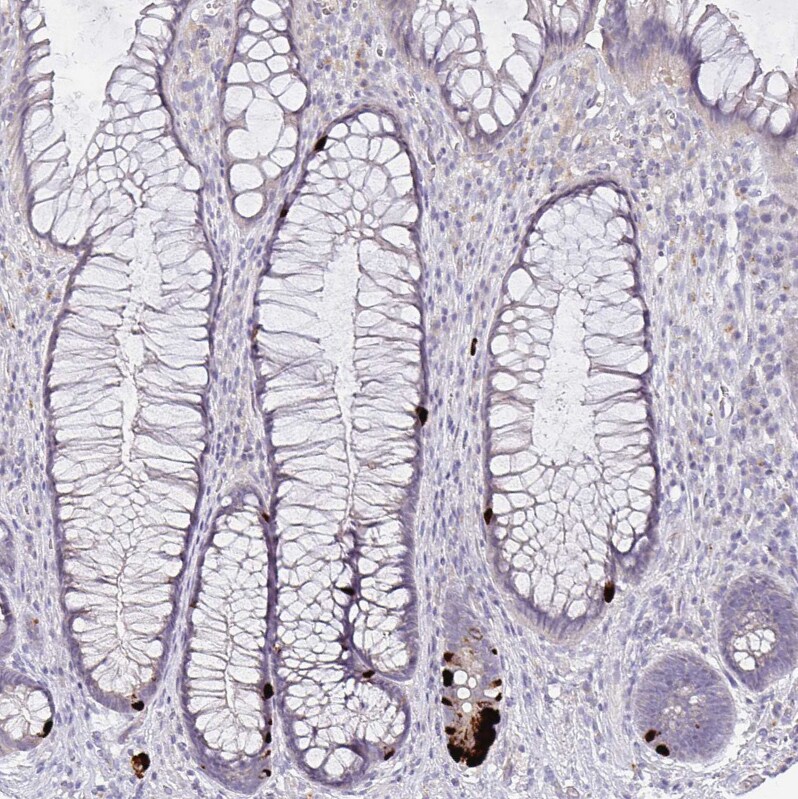 GDF-15 Antibody (CL0328) - Azide and BSA Free Immunohistochemistry-Paraffin: GDF-15 Antibody [NBP3-43983]