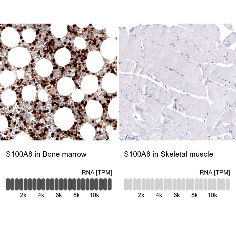 S100A8 Antibody (CL11171) - Azide and BSA Free Immunohistochemistry-Paraffin: S100A8 Antibody [NBP3-43984]