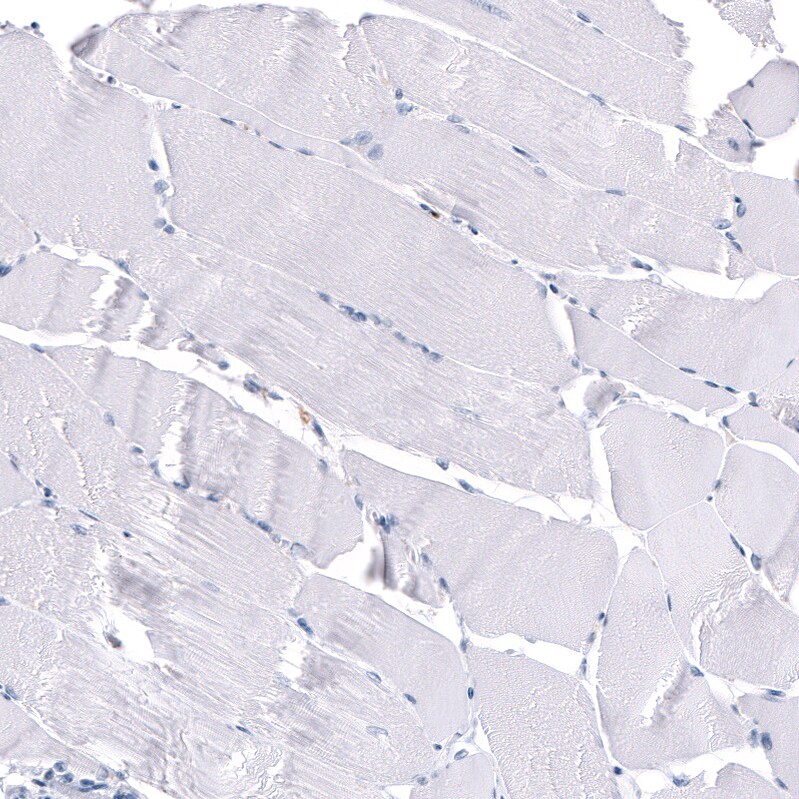 S100A8 Antibody (CL11171) - Azide and BSA Free Immunohistochemistry-Paraffin: S100A8 Antibody [NBP3-43984]