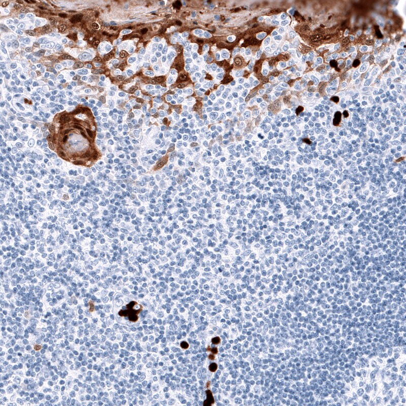 S100A8 Antibody (CL11171) - Azide and BSA Free Immunohistochemistry-Paraffin: S100A8 Antibody [NBP3-43984]