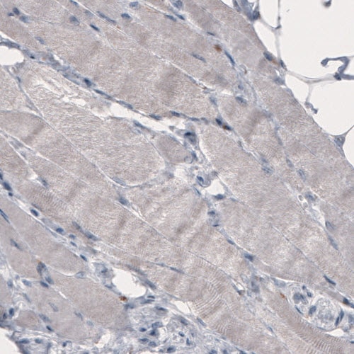 FCRN/FCGRT Antibody (CL3638) - Azide and BSA Free Immunohistochemistry-Paraffin: FCRN/FCGRT Antibody [NBP3-43985]
