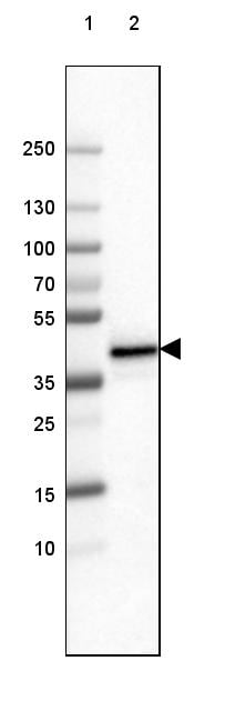 FCRN/FCGRT Antibody (CL3640) - Azide and BSA Free Western Blot: FCRN/FCGRT Antibody [NBP3-43986]