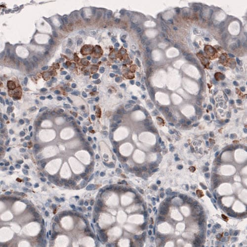 FCRN/FCGRT Antibody (CL3640) - Azide and BSA Free Immunohistochemistry-Paraffin: FCRN/FCGRT Antibody [NBP3-43986]
