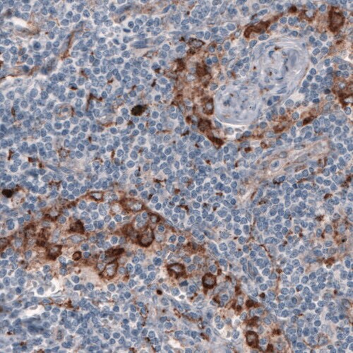 FCRN/FCGRT Antibody (CL3640) - Azide and BSA Free Immunohistochemistry-Paraffin: FCRN/FCGRT Antibody [NBP3-43986]