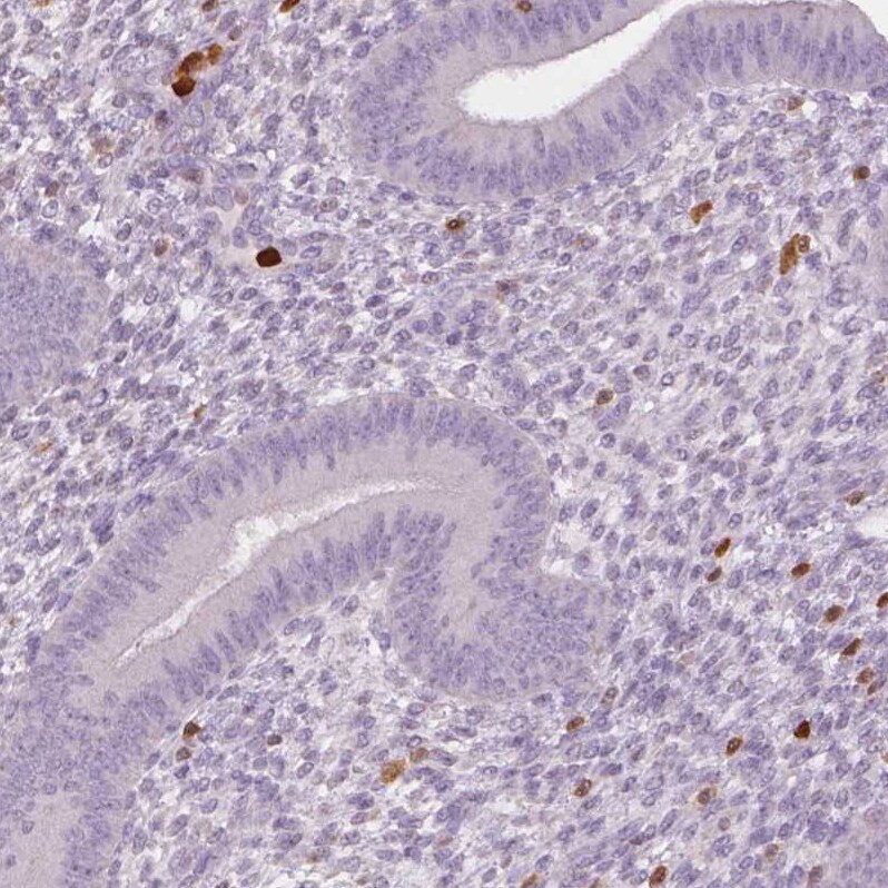 S100A4 Antibody (CL0237) - Azide and BSA Free Immunohistochemistry-Paraffin: S100A4 Antibody [NBP3-43987]