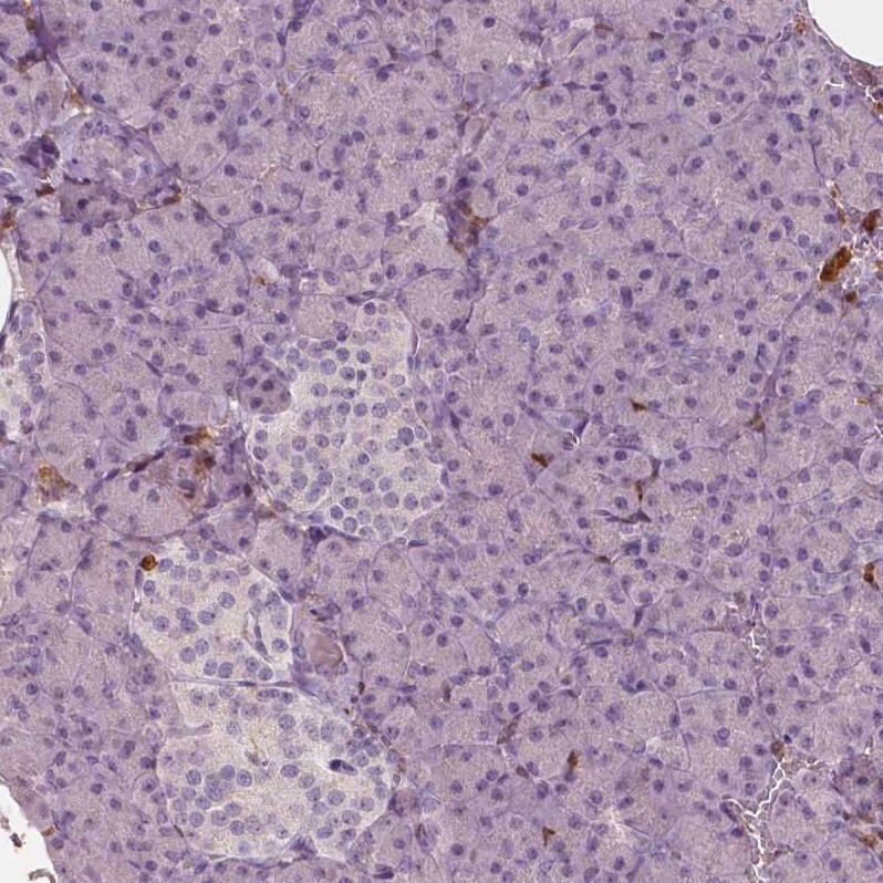 S100A4 Antibody (CL0237) - Azide and BSA Free Immunohistochemistry-Paraffin: S100A4 Antibody [NBP3-43987]