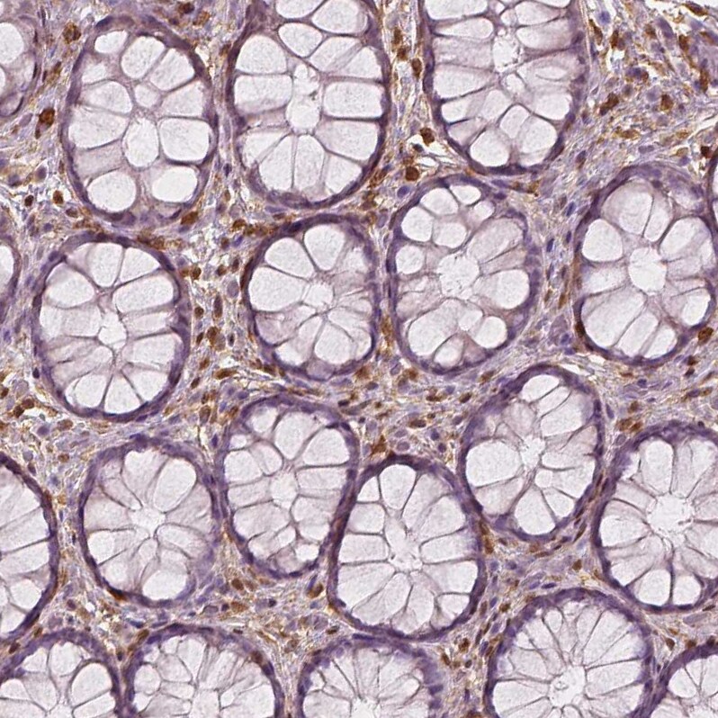 S100A4 Antibody (CL0237) - Azide and BSA Free Immunohistochemistry-Paraffin: S100A4 Antibody [NBP3-43987]
