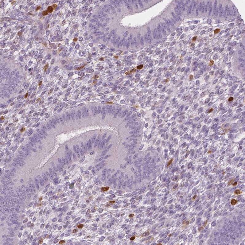 S100A4 Antibody (CL0239) - Azide and BSA Free Immunohistochemistry-Paraffin: S100A4 Antibody [NBP3-43988]