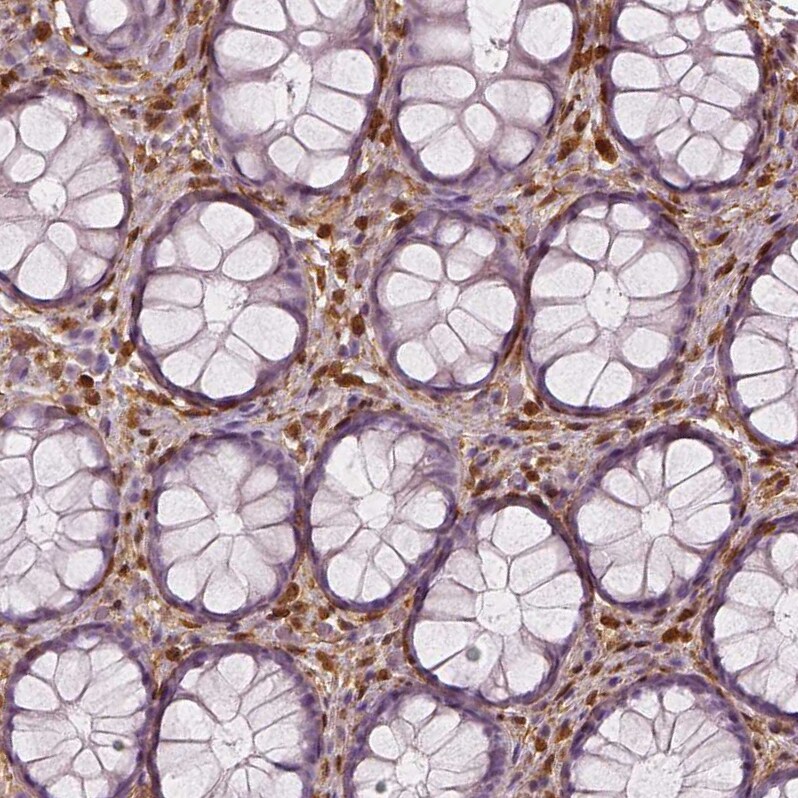 S100A4 Antibody (CL0239) - Azide and BSA Free Immunohistochemistry-Paraffin: S100A4 Antibody [NBP3-43988]
